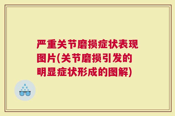 严重关节磨损症状表现图片(关节磨损引发的明显症状形成的图解)