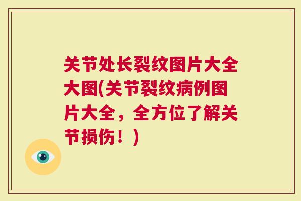 关节处长裂纹图片大全大图(关节裂纹病例图片大全，全方位了解关节损伤！)
