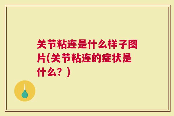 关节粘连是什么样子图片(关节粘连的症状是什么？)