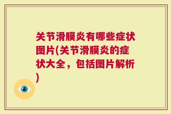 关节有哪些症状图片(关节的症状大全，包括图片解析)